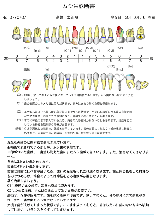 ホワイトニング