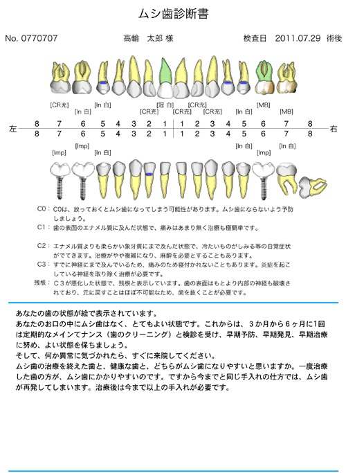 ホワイトニング