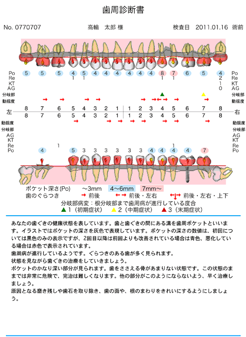 ホワイトニング